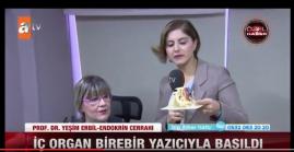 3 boyutlu yazıcı ile tiroid kanseri ameliyatı 